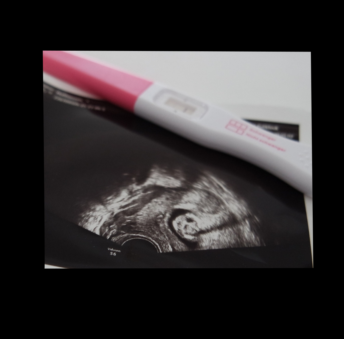 Schwangerschaft und Parodontitis