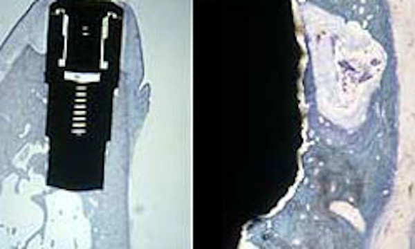 Wie funktioniert es?